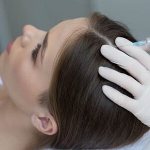 Tratamiento mesoterapia capilar